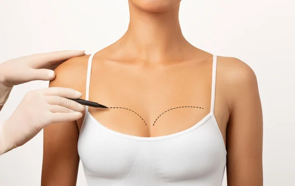 Breast Augmentation