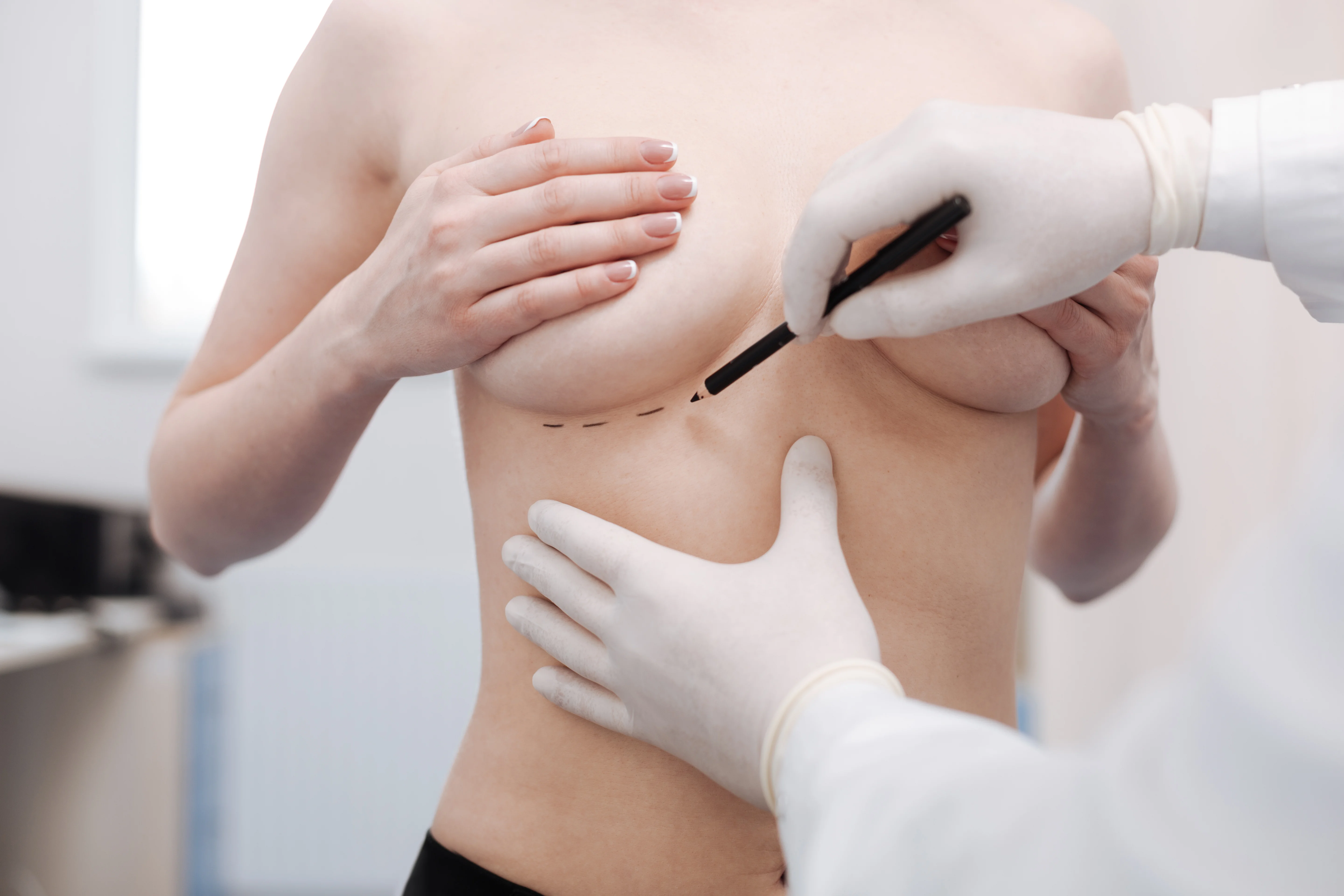 Breast Surgeon